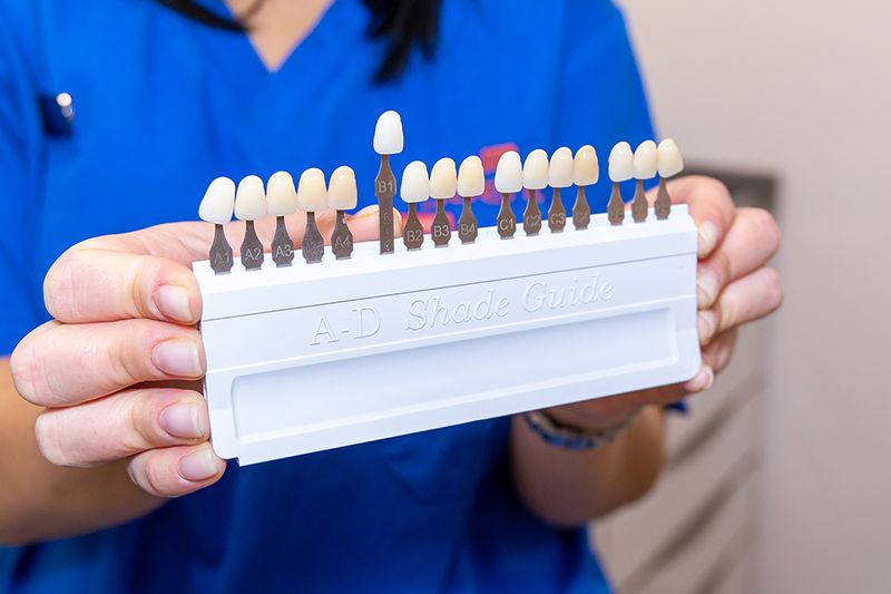 Enlighten Teeth Whitening vs Other Whitening Treatments